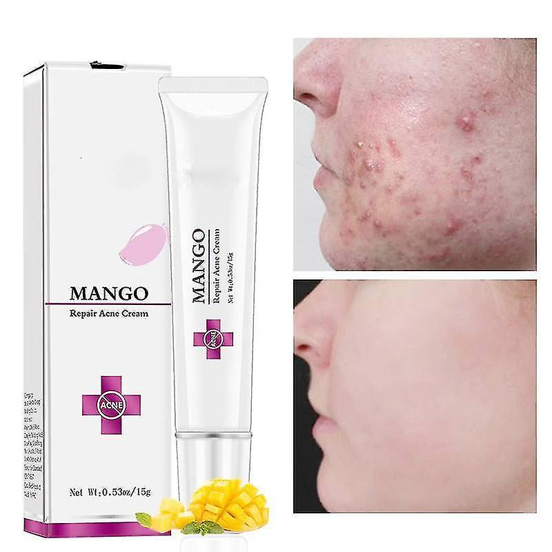 new anti acne spots treatment scar blackhead cream shrink pores whitening sm353