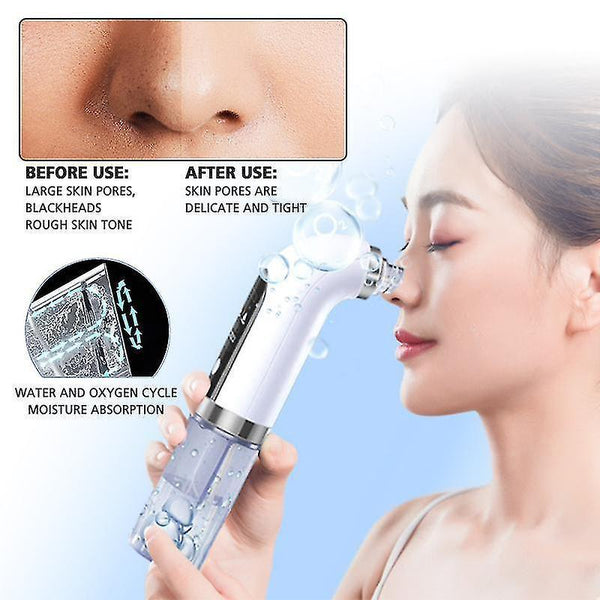 Acne treatments kits blackhead remover vacuum pore cleaner ultrasonic skin scrubber face cleaning bubble skin cleaner