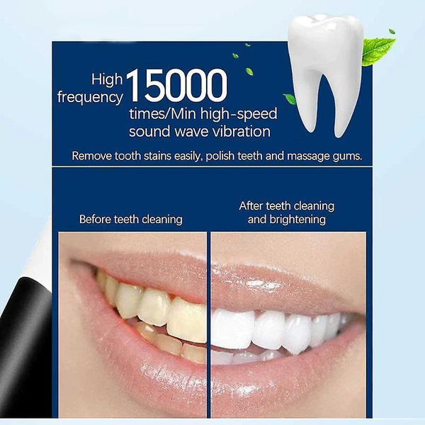 For Sonic Tooth Cleaner Electric Dental Scaler(White) WS10540