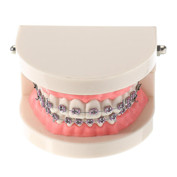 For Dental Teeth Malocclusion Orthodontic Model With Full Metal Brackets Hoops Dentist Teaching WS41715