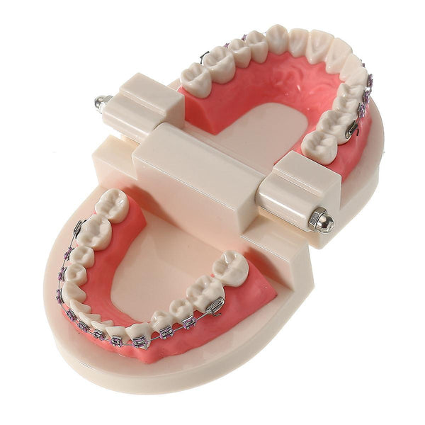 For Dental Teeth Malocclusion Orthodontic Model With Full Metal Brackets Hoops Dentist Teaching WS41715