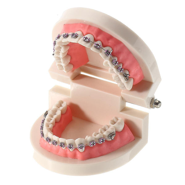 For Dental Teeth Malocclusion Orthodontic Model With Full Metal Brackets Hoops Dentist Teaching WS41715