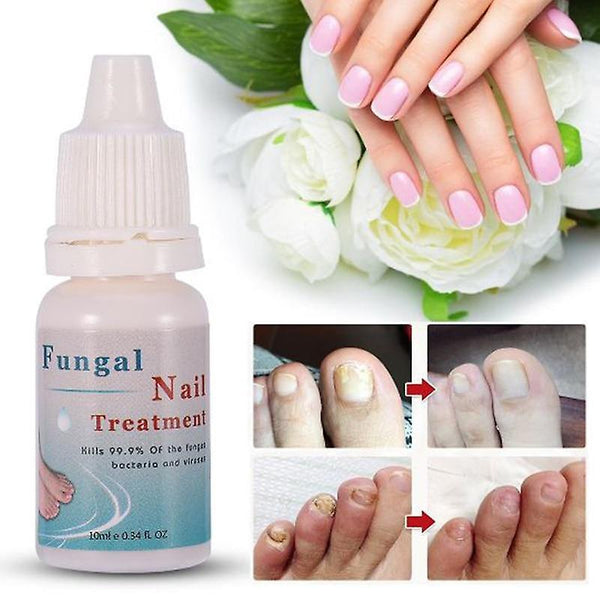 Nail Fungus Treatment Nails Repair Liqui SM56060